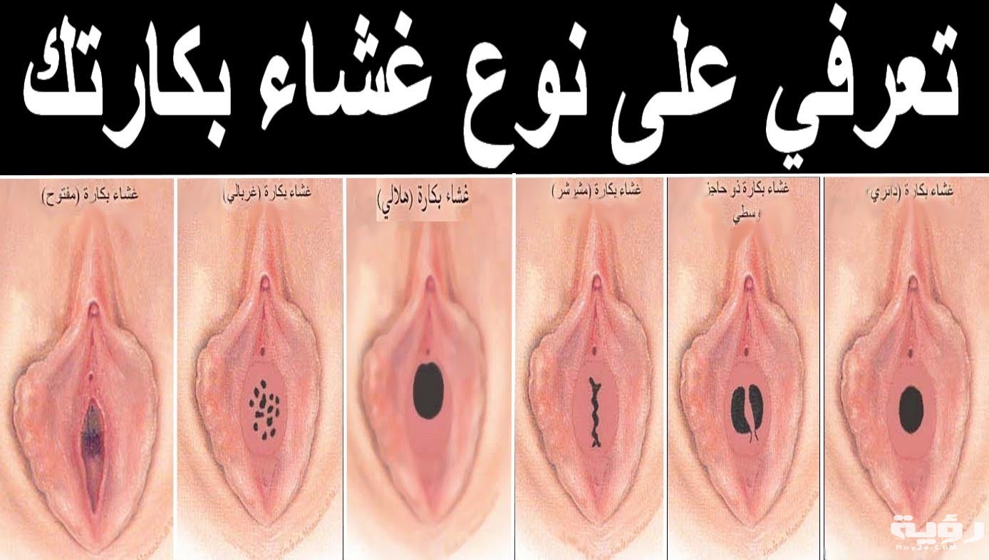 تفسير رؤية فرج الفتاة في المنام 5 6518 2