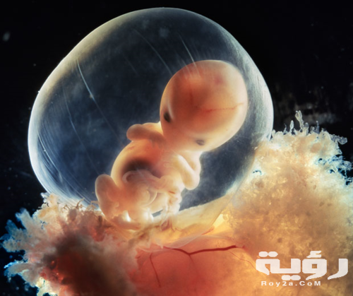 الاجهاض في المنام