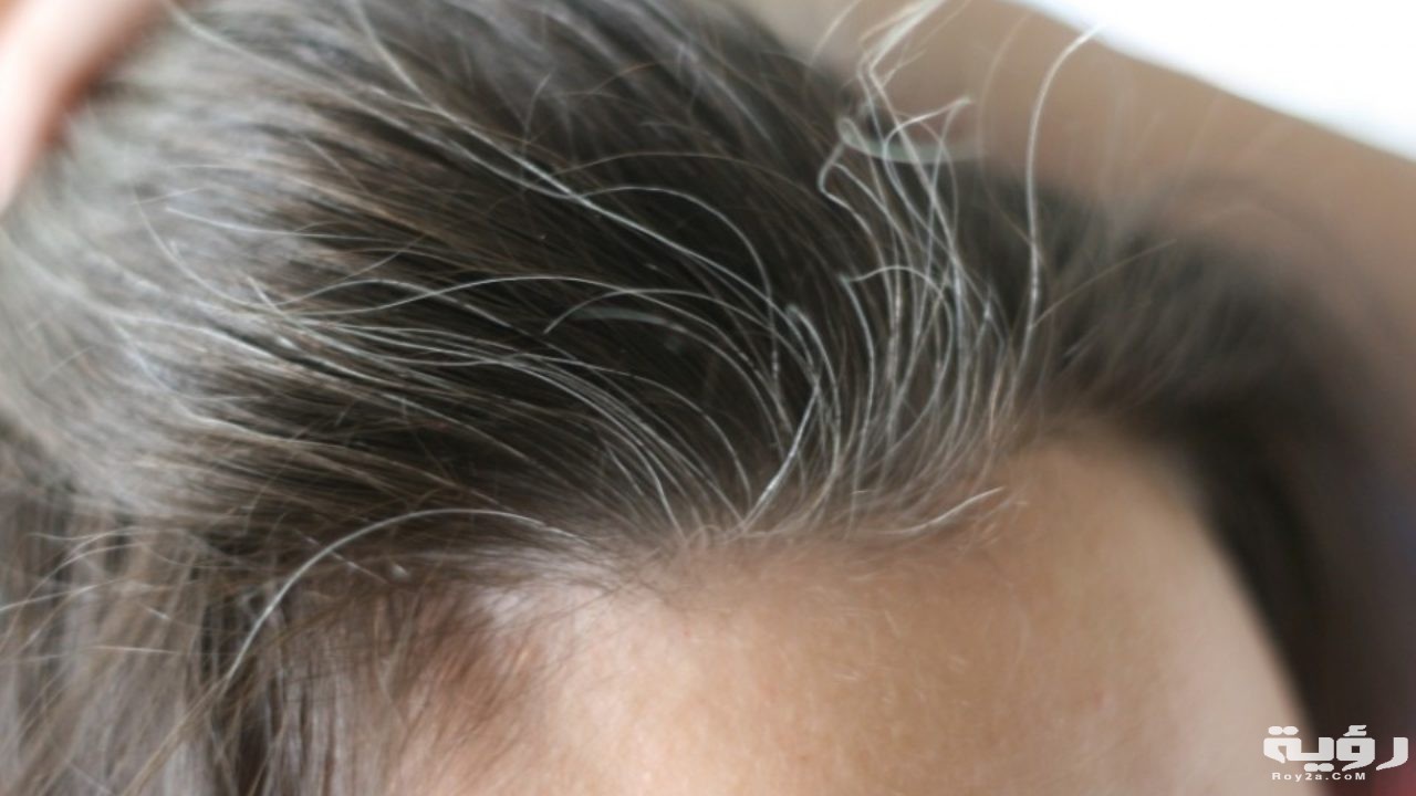 httpsrotana.netassetsuploads201702الشعر الأبيض 1280x720 1