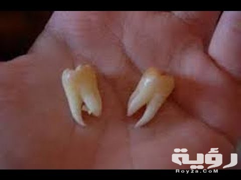 حلمت اني خلعت ضرسي 4 0 28