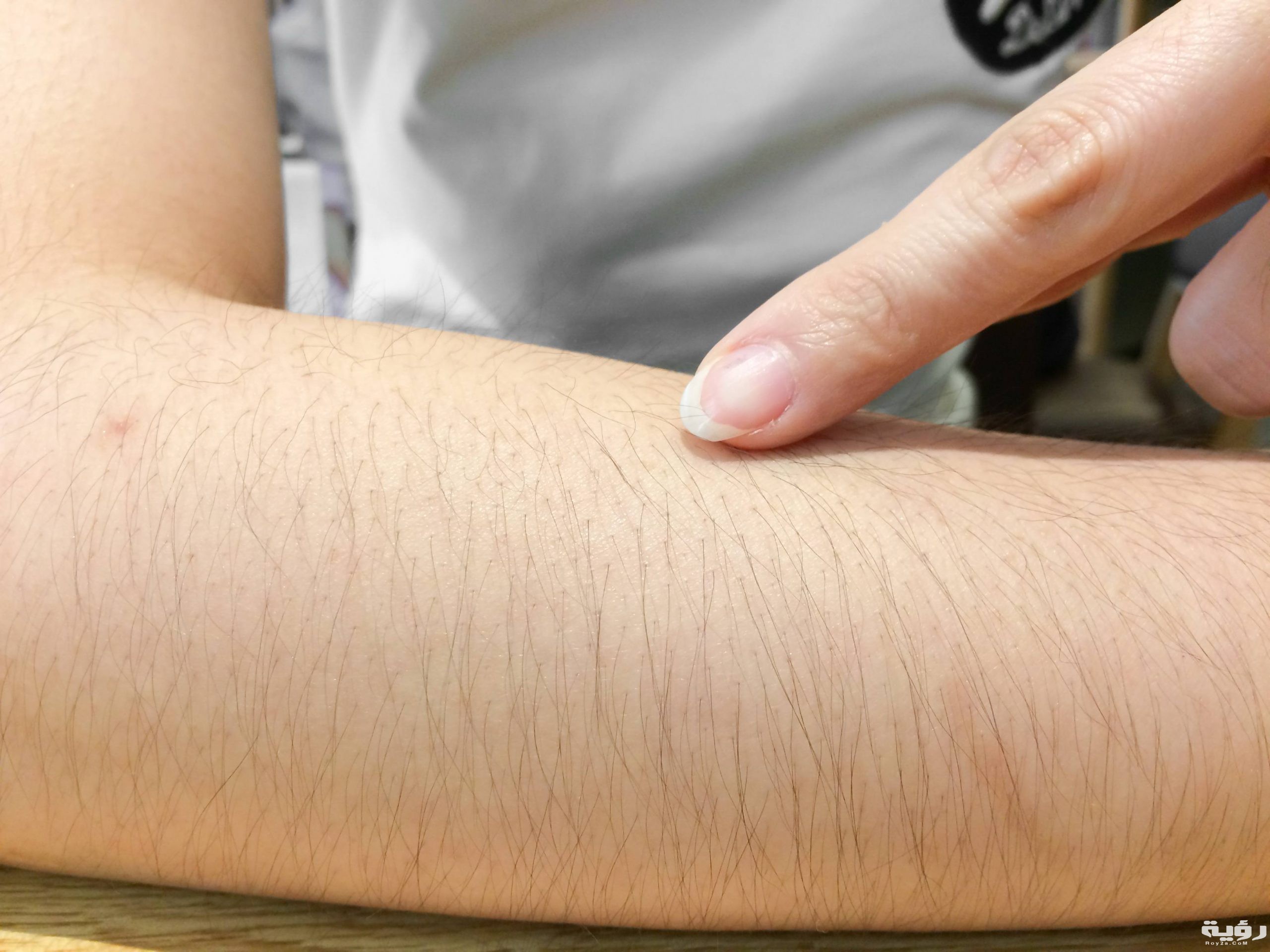 شعر الذراع للمرأة scaled 1