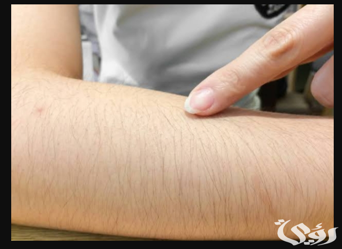 أشهر 6 تفسيرات رؤية حلق شعر العانة في المنام 3 تفسير حلم حلق شعر العانة