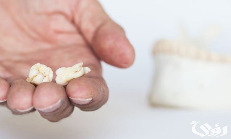 ما تفسير حلم رؤية سقوط الضرس في اليد للمتزوجة 5 تفسير حلم سقوط الضرس في اليد للمتزوجة