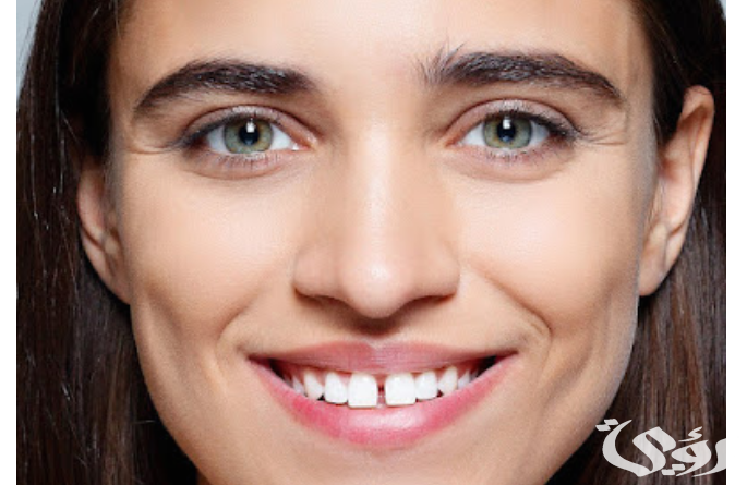 تفسير حلم الأسنان الأمامية متفرقة