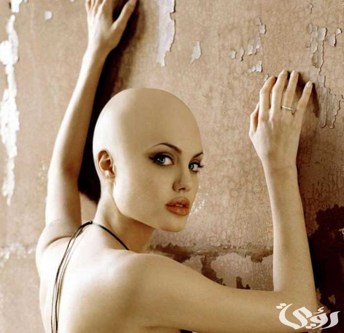 تفسير حلم رؤية المرأة الصلعاء في المنام